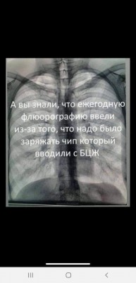 Рентгеновский снимок грудной клетки с текстом