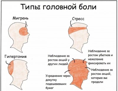 Типы головной боли с описанием и локализацией